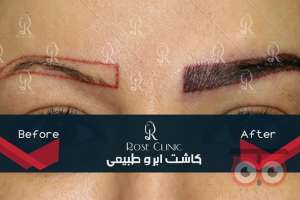 تمدید جشنواره کاشت تمدید جشنواره کاشت