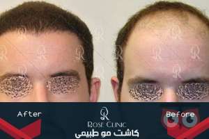 تمدید جشنواره کاشت تمدید جشنواره کاشت