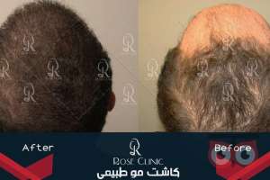 تمدید جشنواره کاشت تمدید جشنواره کاشت