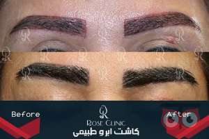 تمدید جشنواره کاشت تمدید جشنواره کاشت