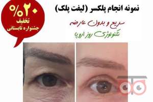 تخفیف ویژه پلکسر تخفیف ویژه پلکسر
