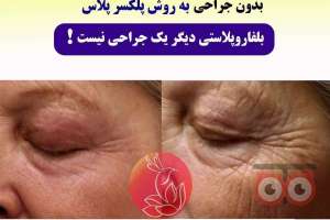 تخفیف ویژه پلکسر تخفیف ویژه پلکسر