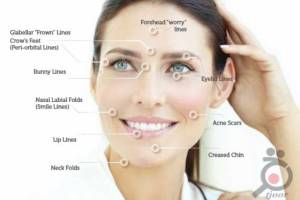 تخفیف ویژه تیکسل تخفیف ویژه تیکسل