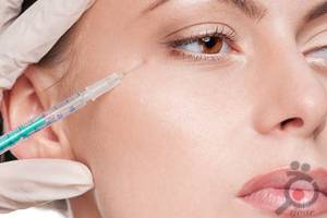 تخفیف ویژه تزریق فیلر تخفیف ویژه تزریق فیلر