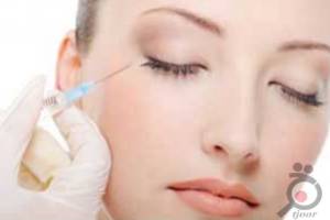 تخفیف ویژه تزریق فیلر تخفیف ویژه تزریق فیلر