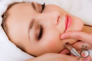 تخفیف ویژه میکرودرم ابریژن تخفیف ویژه میکرودرم ابریژن