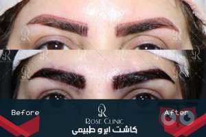 جشنواره کلینیک رز جشنواره کلینیک رز