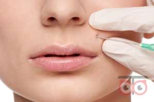 جشنواره تزریق چربی جشنواره تزریق چربی