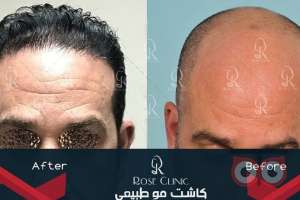 جشنواره کلینیک رز جشنواره کلینیک رز