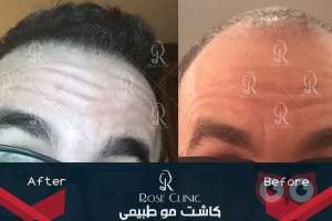 جشنواره کلینیک رز جشنواره کلینیک رز