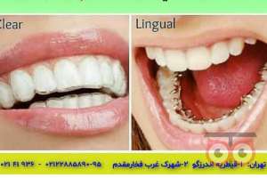 تخفیف ویژه خدمات درمانی دهان و دندان تخفیف ویژه خدمات درمانی دهان و دندان