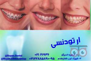 تخفیف ویژه خدمات درمانی دهان و دندان