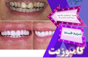 تخفیف ویژه خدمات درمانی دهان و دندان تخفیف ویژه خدمات درمانی دهان و دندان