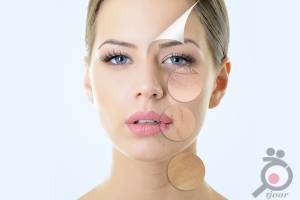 تخفیف ویژه لیزر ND تخفیف ویژه لیزر ND