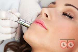 تخفیف ویژه آر اف و میکرودرم تخفیف ویژه آر اف و میکرودرم