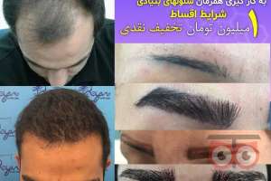 جشنواره تابستان کلینیک رویان جشنواره تابستان کلینیک رویان