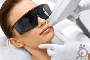 تخفیف ویژه لیزر تخفیف ویژه لیزر