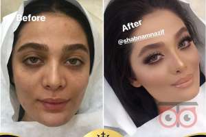 بازدید عروس همراه با آفر ویژه بازدید عروس همراه با آفر ویژه