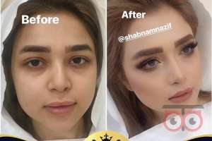 بازدید عروس همراه با آفر ویژه بازدید عروس همراه با آفر ویژه