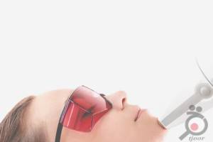 تخفیف زمستانی لیزر تخفیف زمستانی لیزر