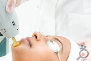 تخفیف زمستانی لیزر تخفیف زمستانی لیزر