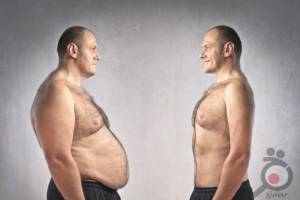 تخفیف ویژه زمستانی جراحی ماستوپکسی تخفیف ویژه زمستانی جراحی ماستوپکسی