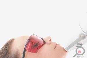 تخفیف ویژه پکیج لیزر تخفیف ویژه پکیج لیزر