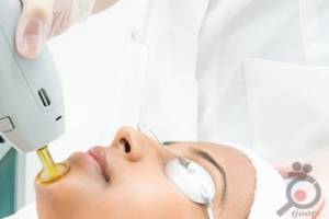 تخفیف ویژه پکیج لیزر تخفیف ویژه پکیج لیزر