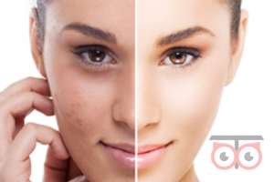 تخفیف ویژه خدمات زیبایی در کلینیک دکتر جلیل زاده تخفیف ویژه خدمات زیبایی در کلینیک دکتر جلیل زاده