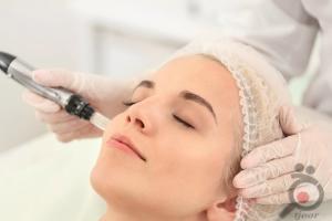 تخفیف ویژه لیزر موهای زائد در کلینیک پوست و لیزر ونوس تخفیف ویژه لیزر موهای زائد در کلینیک پوست و لیزر ونوس