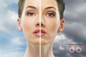 تخفیف ویژه پاکسازی پوست تخفیف ویژه پاکسازی پوست
