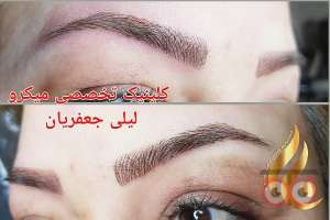 تخفیف ویژه خدمات میکروپیگمنتیشن تخفیف ویژه خدمات میکروپیگمنتیشن