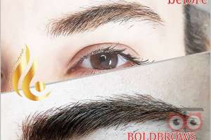 تخفیف ویژه خدمات میکروپیگمنتیشن تخفیف ویژه خدمات میکروپیگمنتیشن