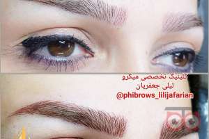 تخفیف ویژه خدمات میکروپیگمنتیشن تخفیف ویژه خدمات میکروپیگمنتیشن