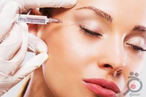 تخفیف ویژه بوتاکس تخفیف ویژه بوتاکس