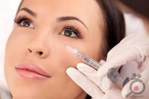 تخفیف ویژه بوتاکس تخفیف ویژه بوتاکس