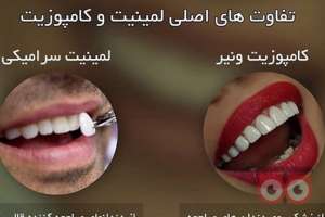 جشنواره تخفیفات خدمات دهان و دندان