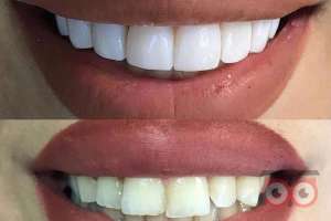 جشنواره تخفیفات خدمات دهان و دندان