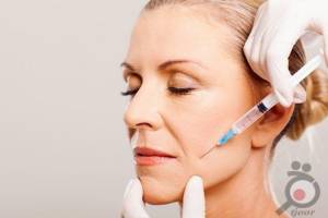 تخفیف ویژه ژل و بوتاکس تخفیف ویژه ژل و بوتاکس