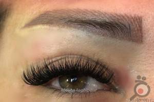 تخفیف ویژه انجام میکروپیگمنتیشن تخفیف ویژه انجام میکروپیگمنتیشن