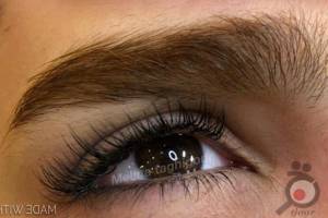 تخفیف ویژه انجام میکروپیگمنتیشن تخفیف ویژه انجام میکروپیگمنتیشن