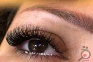 تخفیف ویژه انجام میکروپیگمنتیشن تخفیف ویژه انجام میکروپیگمنتیشن