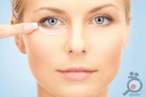 تخفیف تزریق ژل آلمانی تخفیف تزریق ژل آلمانی