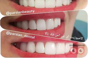 تخفیف ویژه دندانپزشکی پارسیان