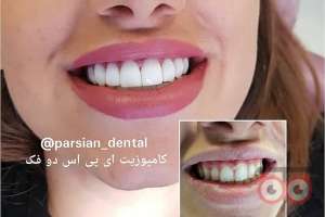 تخفیف ویژه دندانپزشکی پارسیان