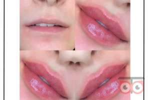 تخفیف ویژه خدمات زیبایی کلینیک دریتا تخفیف ویژه خدمات زیبایی کلینیک دریتا