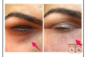 تخفیف ویژه خدمات زیبایی کلینیک دریتا تخفیف ویژه خدمات زیبایی کلینیک دریتا