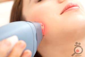 تخفیف ویژه شعبان لیزر موهای زائد تخفیف ویژه شعبان لیزر موهای زائد
