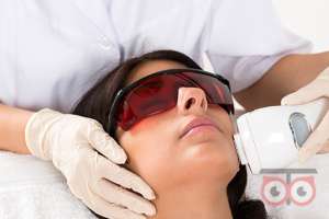 تخفیف لیزر تخفیف لیزر