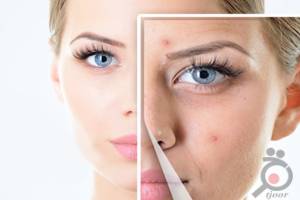 تخفیف خدمات زیبایی کلینیک دکتر فتح آبادی تخفیف خدمات زیبایی کلینیک دکتر فتح آبادی